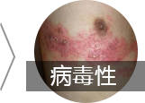 皮肤病