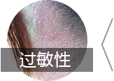 皮肤病医院